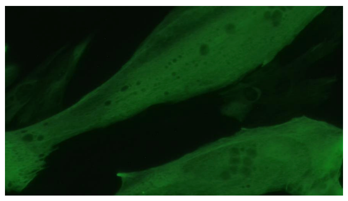 <tc>WildBio</tc> スプリングボックマイオブラスト細胞株 – 筋肉