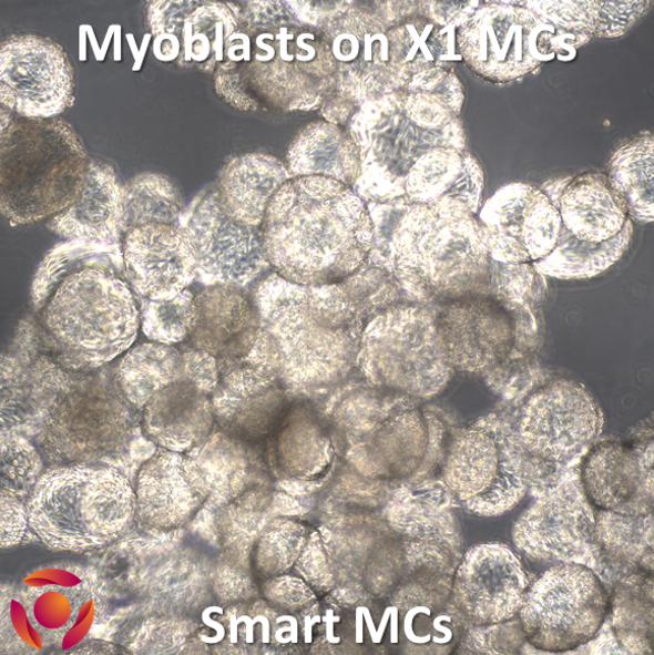 <tc>Smart MCs</tc> X1 마이크로캐리어
