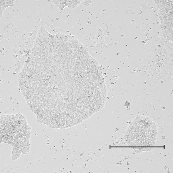 <tc>Qkine</tc> 再組換え豚ビトロネクチンタンパク質