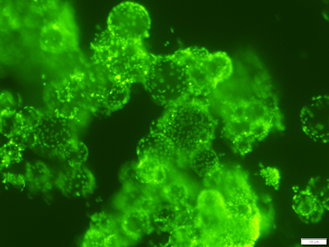 Smart MCs P1 Microcarriers